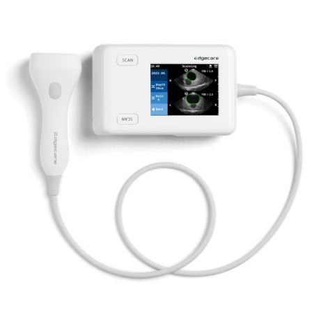 Scanner Vésical Edgeflow Uh10